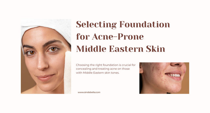 Acne-Prone Skin Foundation: Tips for Finding the Right Formula to Conceal and Heal for Middle Eastern Skin Tone